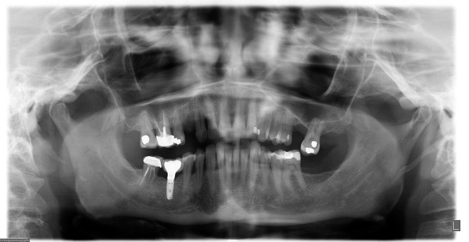 RX - Pre Operaci&oacute;n