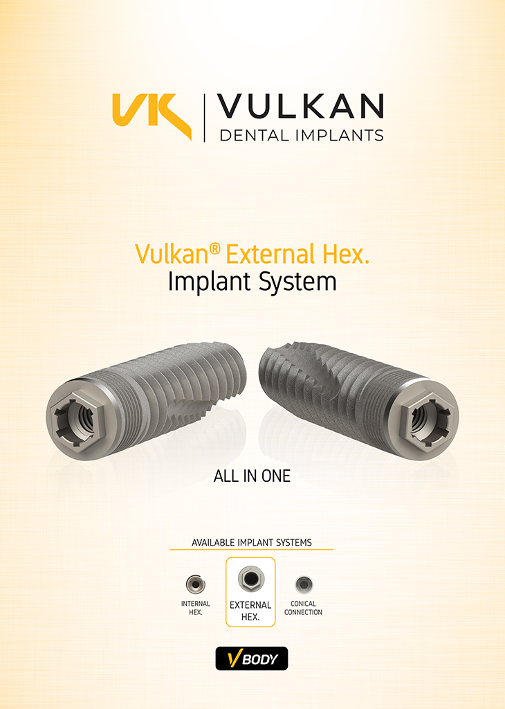 Vulkan Implants Catalogue External Hex. VBody