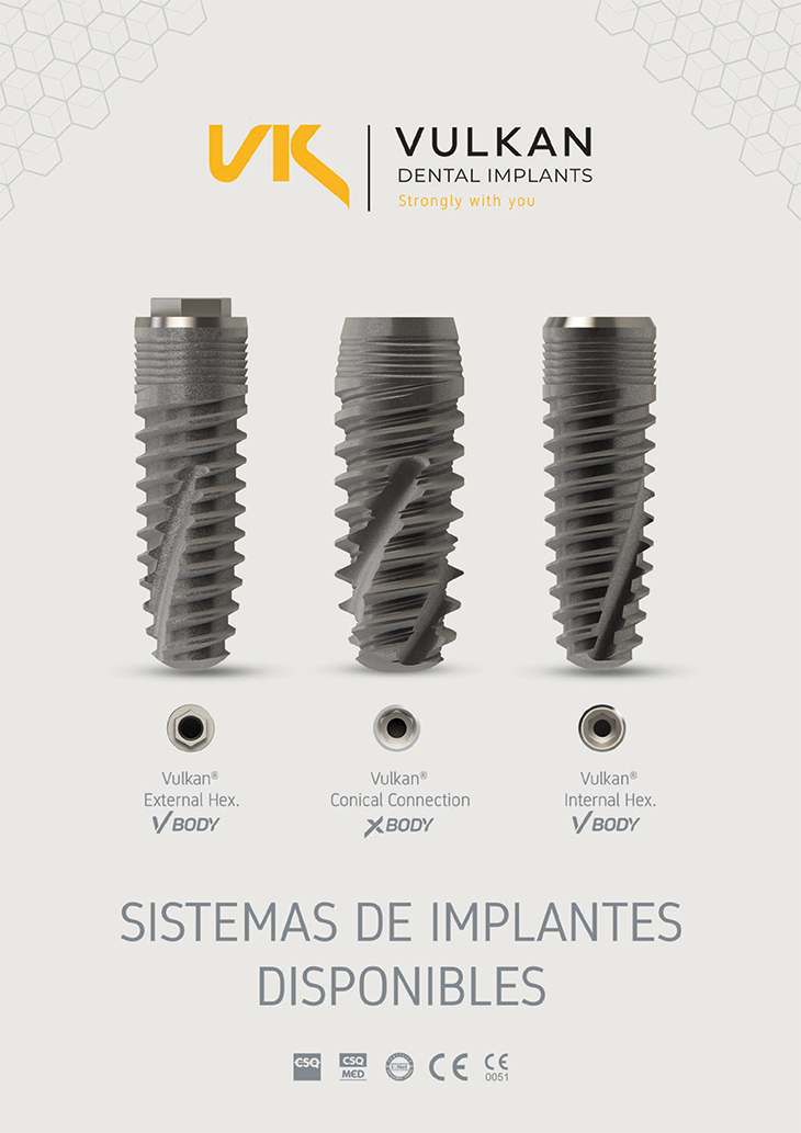 Catálogo resumido sistema de implantes dentales vulkan
