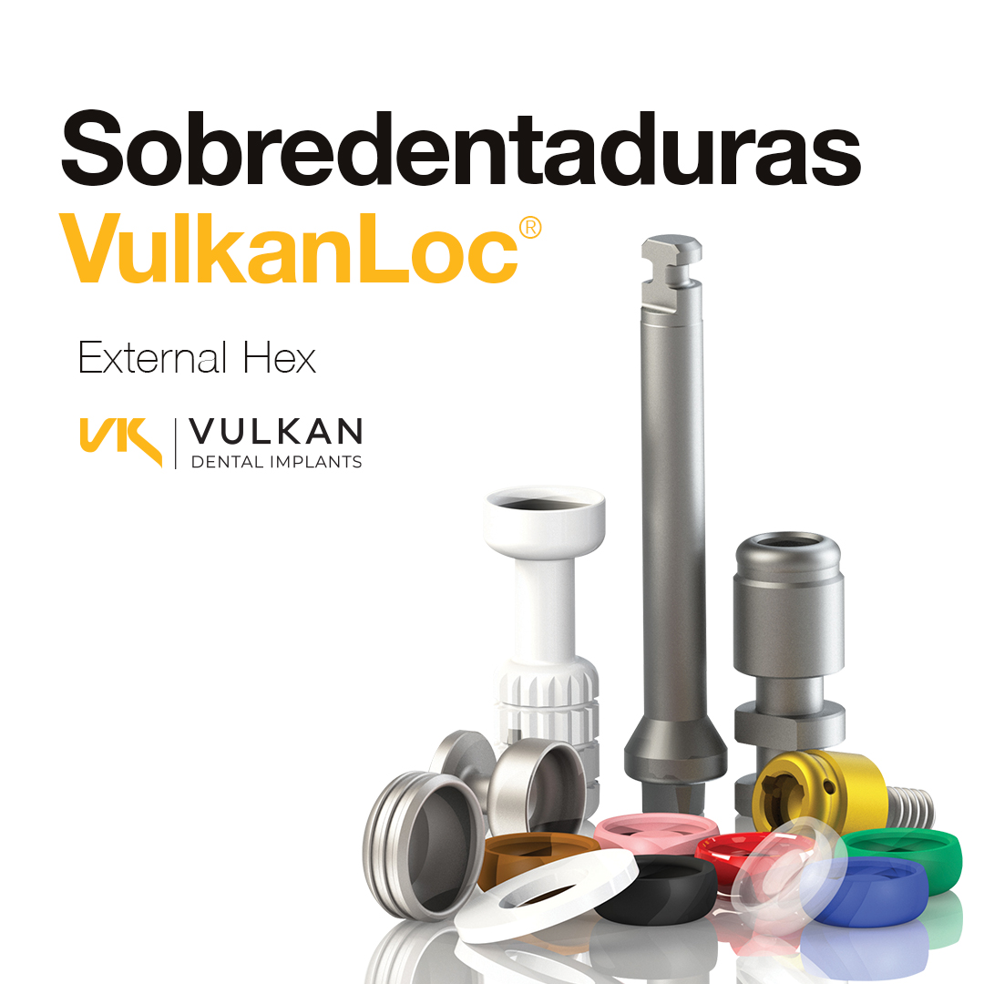 sobredentaduras vulkanloc external hexagon