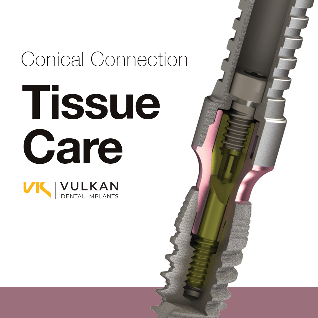 Transepitelial Tissue Care para el sistema de implantes dentales Vulkan Implants Conical Connection