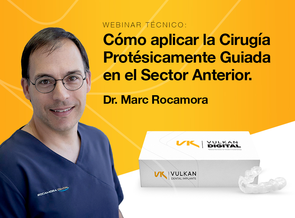 Cómo aplicar la Cirugía Protésicamente Guiada en el sector anterior